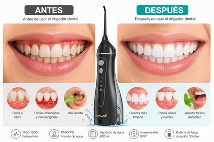 Portable Oral Irrigator with Nozzles